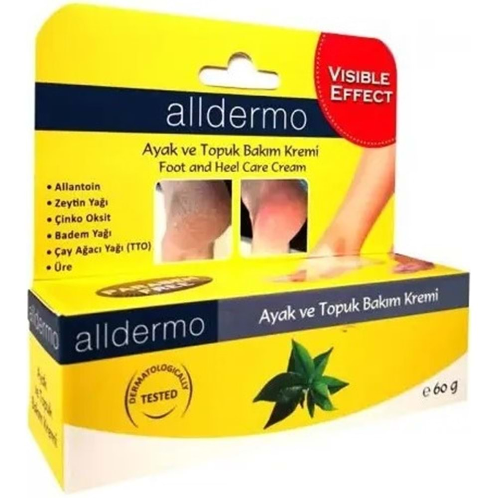 ALLDERMO TOPUK ÇATLAK KREMİ