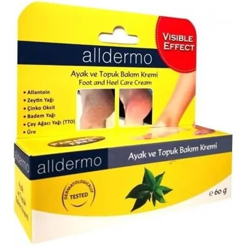 ALLDERMO TOPUK ÇATLAK KREMİ